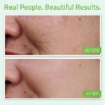 YEOUTH Hyaluronic Acid Plus 30 ML – Image 3