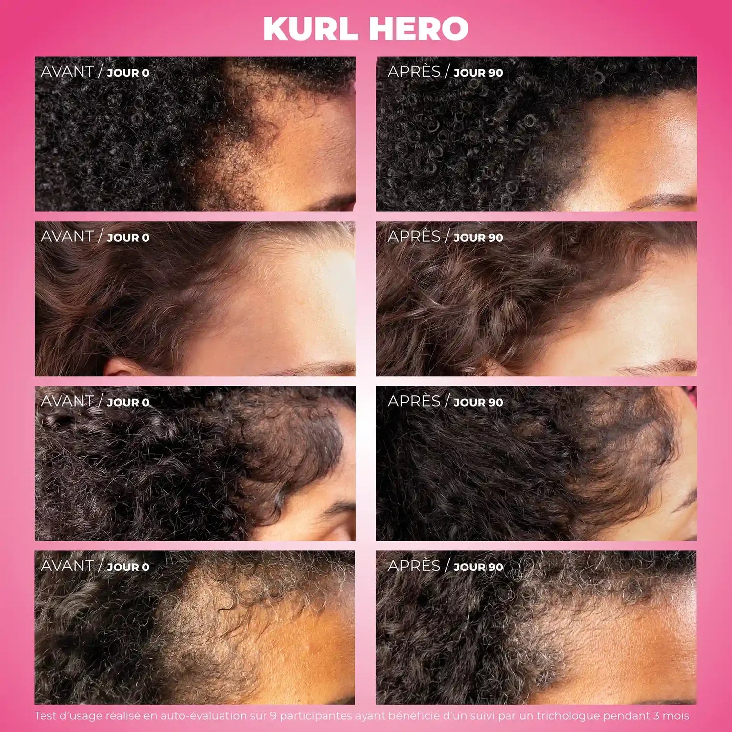 LES SECRETS DE LOLY KURL HERO SÉRUM ANTI-CHUTE CROISSANCE DENSIFIANT 50ML – Image 9